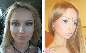 芭比整容爆料视频,视频爆料揭露明星美容秘密  第1张